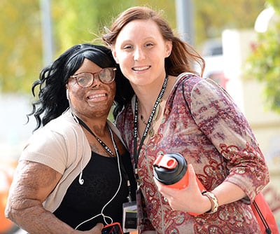 Two women, one with a burn injury on her face and arm, smiling with their arm around one another