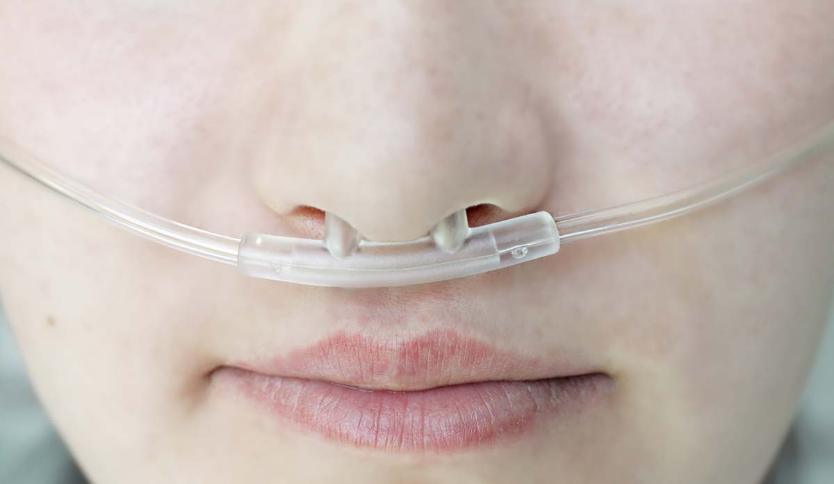 Closeup of a person wearing a Respiratory oxygen nasal catheter